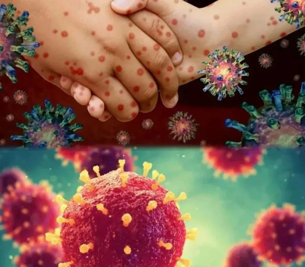 Маңғыстау облысында қызылша ауруы өршіп тұр: Көрсеткіш 1,5 есеге өскен